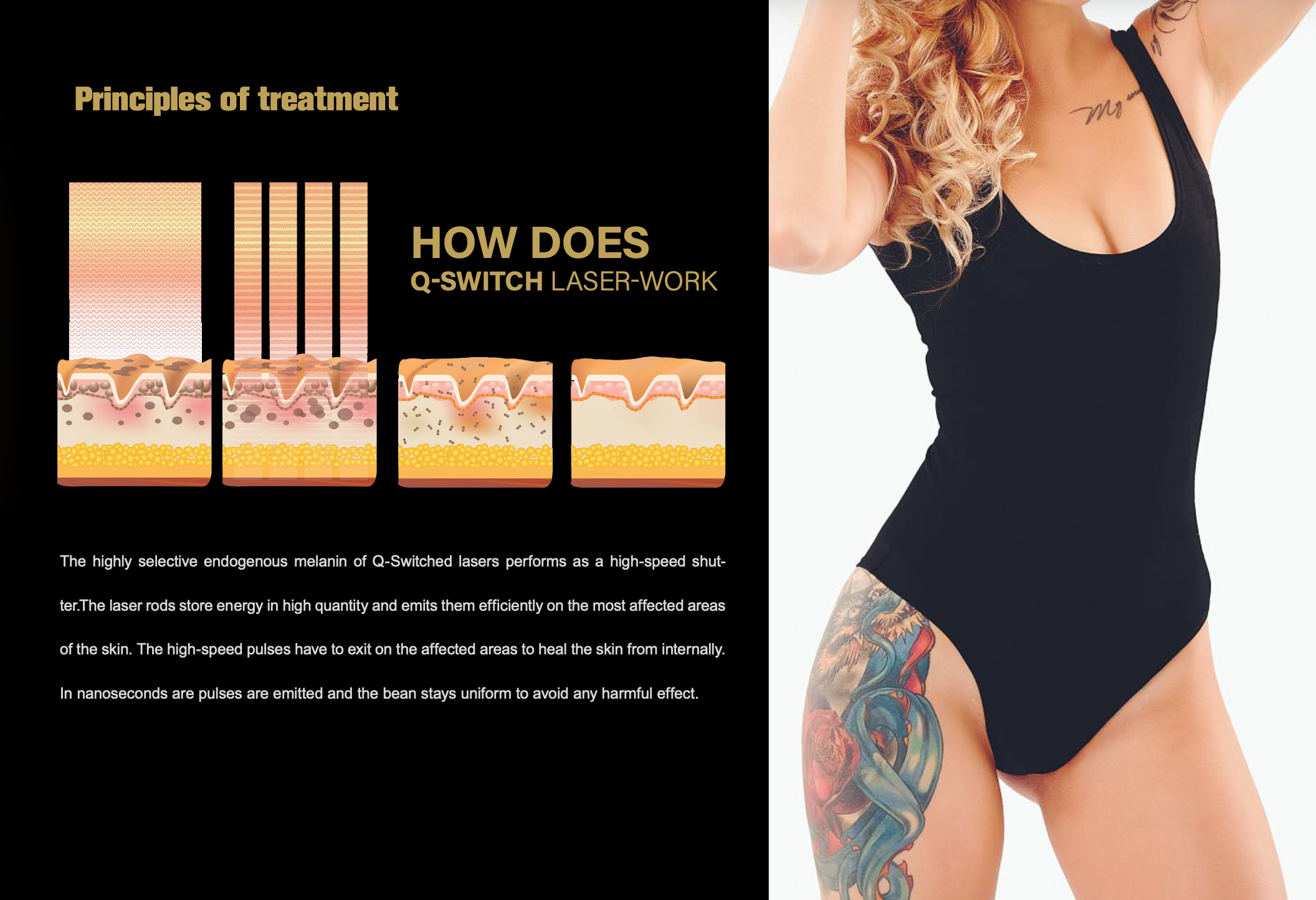 Best You Q Swithched Nd Yag Laser