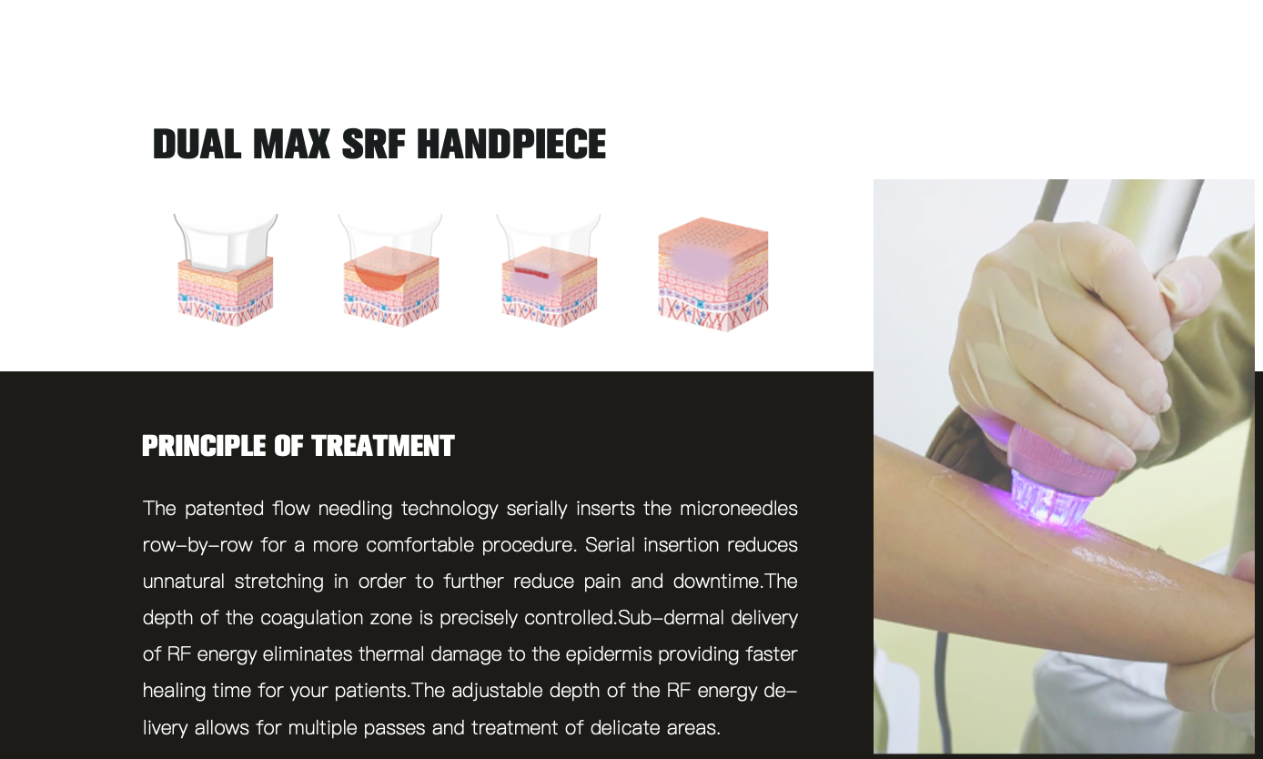 DUAL MAX SRF HANDPIECE