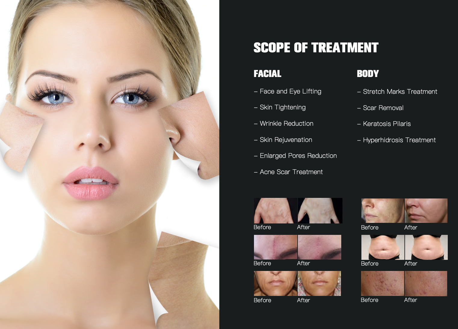 SCOPE OF TREATMENT