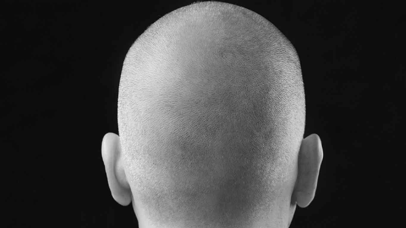 VTCT Skills (ITEC) Level 4 Award in Scalp Micropigmentation Treatments delivered by Best You Training